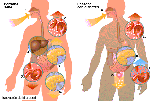 enfermedad de diabetes mellitus