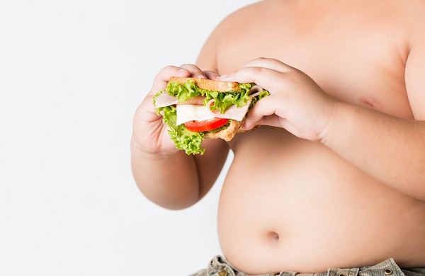 Obesitas Anak Berisiko Terkena Penyakit Mental