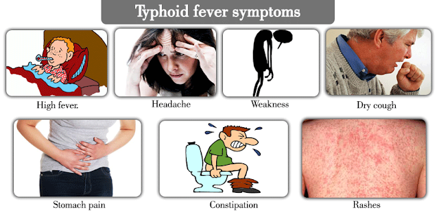 typhoid fever research essay Typhoid fever this essay typhoid fever it multiplies and spreads to the bloodstream causing the onset of fever and other symptoms typhoid however research. typhoid fever research essay Typhoid fever this essay typhoid fever it multiplies and spreads to the bloodstream causing the onset of fever and other symptoms typhoid however research.