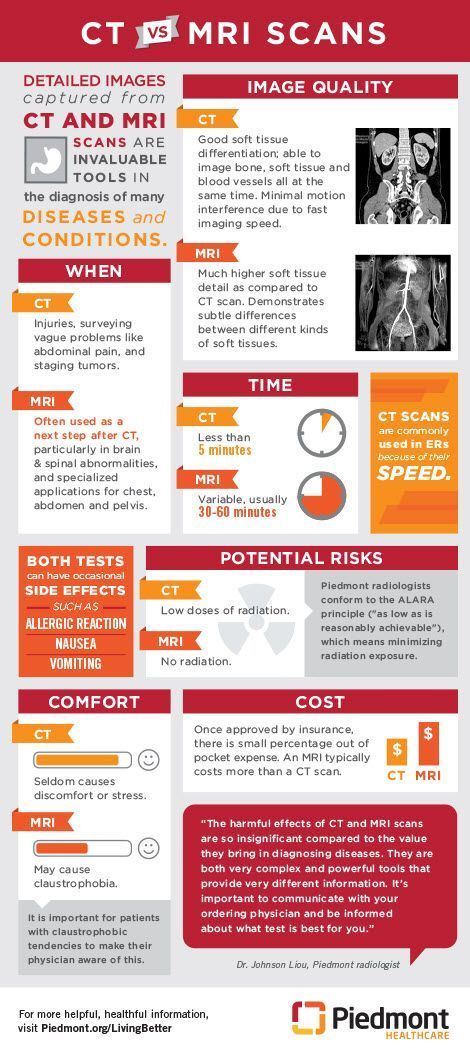 Infographic: CT vs MRI Scans