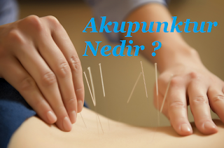 Akupunktur Nedir Akupunktur Nedir