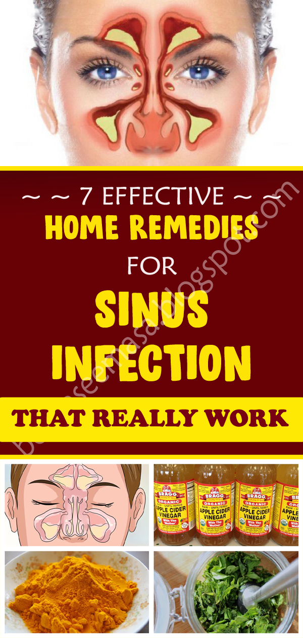 9 Effective Home Remedies For Sinus Infection nutrition health