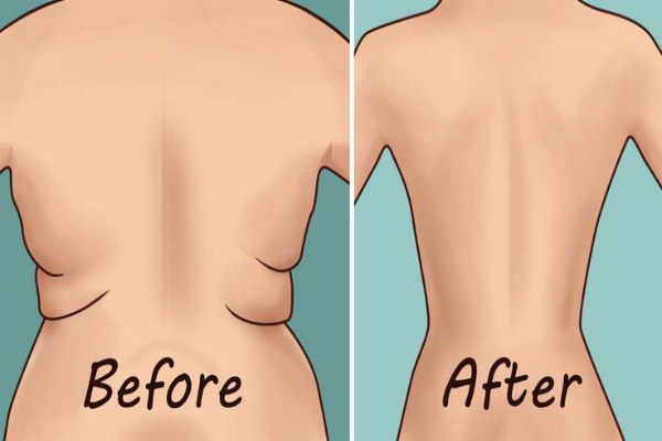 Eliminar la grasa dorsal y las axilas Flab con 4 ejercicios rápidos Eliminar la grasa dorsal y las axilas Flab con 4 ejercicios rápidos