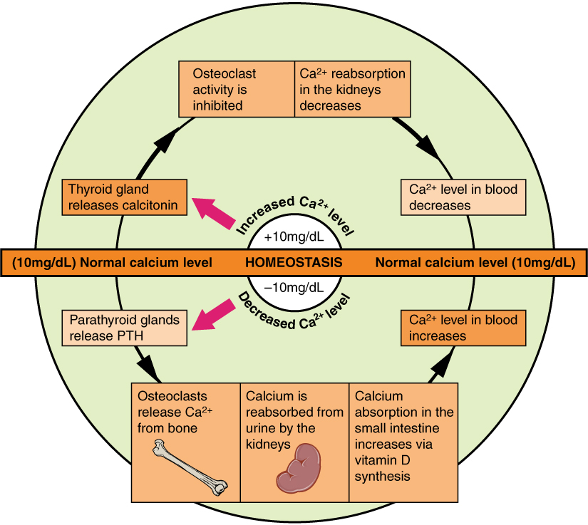Epiphany Low Bone Density in Autism and Brain Calcification (Bone