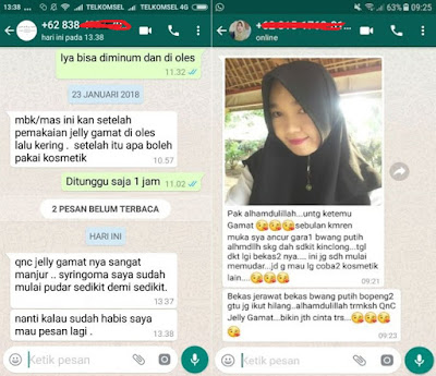 Cara Menghilangkan Bercak Putih Di Wajah Yang Menyerupai Panu Cara Menghilangkan Bercak Putih Di Wajah Yang Menyerupai Panu