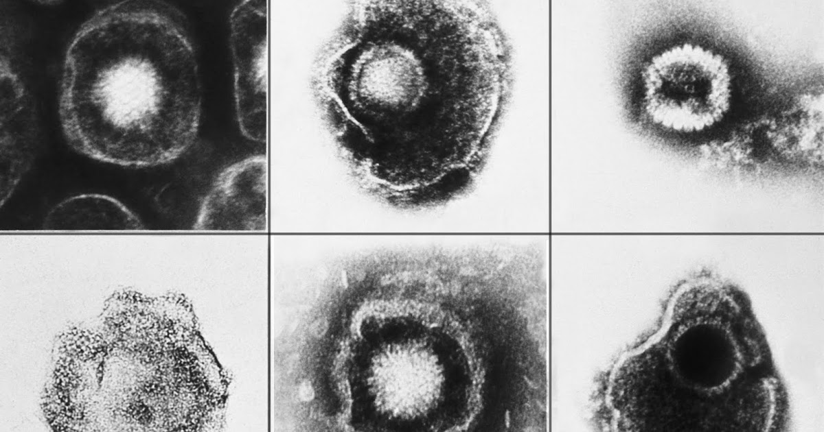 Обезьяний герпес. Herpesviridae микробиология. Вирус генитального герпеса.