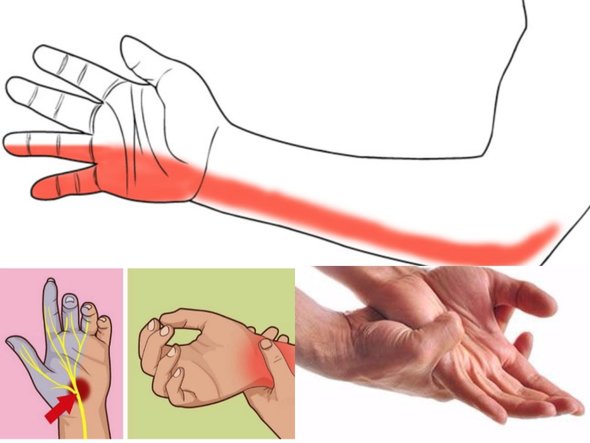 Simti dureri la nivel articulat si amorteala la nivelul degetelor? Iata ce trebuie sa afli urgent! 