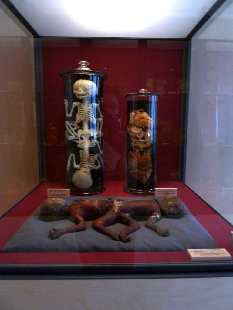 Frau Doktor Doctor Copenhagen the Medical Museion