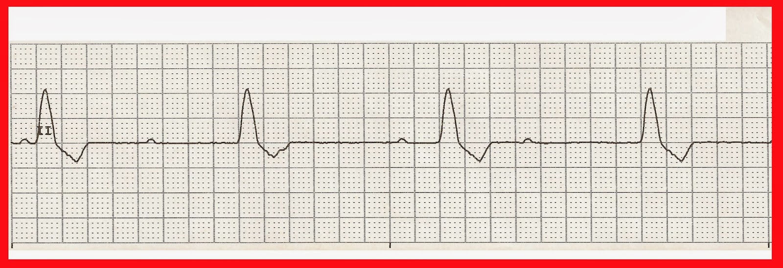 Ekg Practice Strips Printable - Printable World Holiday