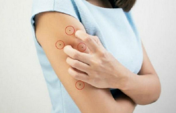 88 Arti Kedutan Lengan Kanan Menurut Islam Dan Primbon Lengkap Pertanda Kedutan Tangan