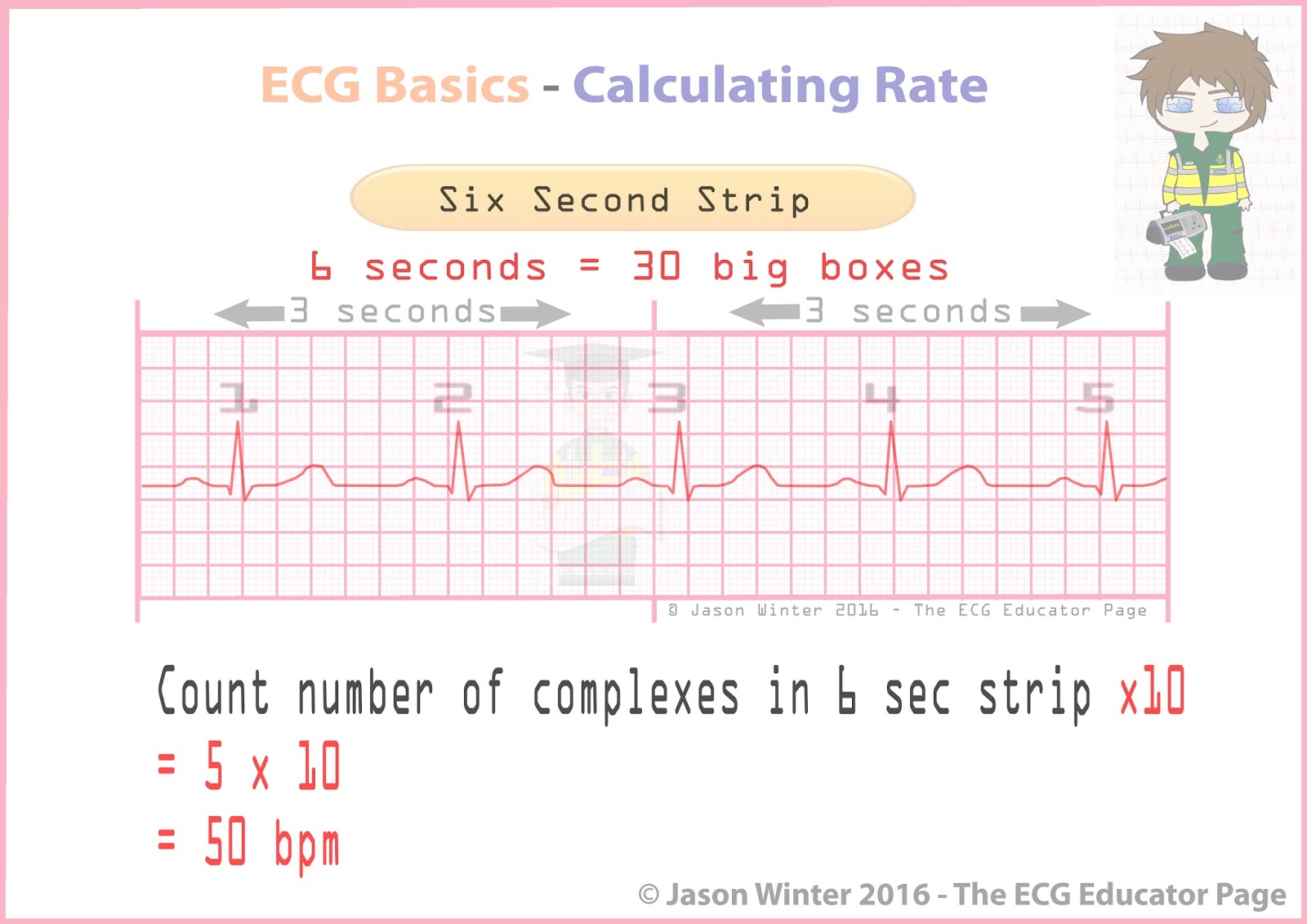 How To Calculate Heart Rate In Ecg Strip - Haiper