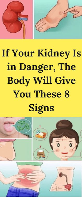 If Your Kidney Is in Danger, The Body Will Give You These 8 Signs