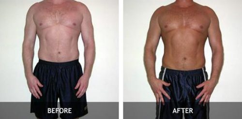 What Are the Effects of Melanotan and Melanotan II? - MomLovePassion