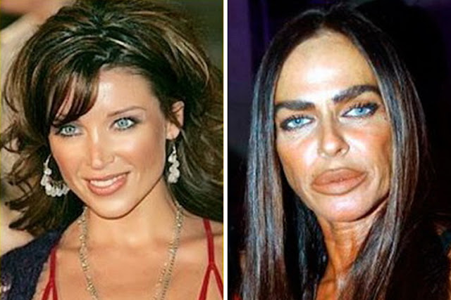 7 WORST PLASTIC SURGERIES FAIL IN HOLLYWOOD - NEWSOLOGYS