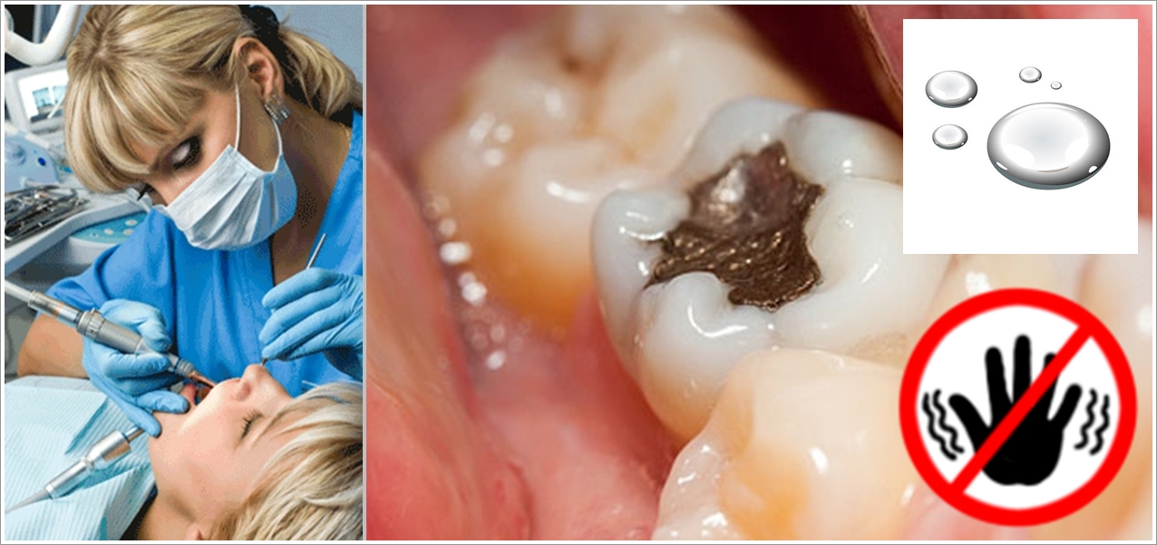 MercuryFree Dentistry Campaign