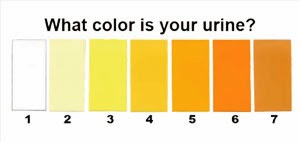 Urine Color And Odor Chart