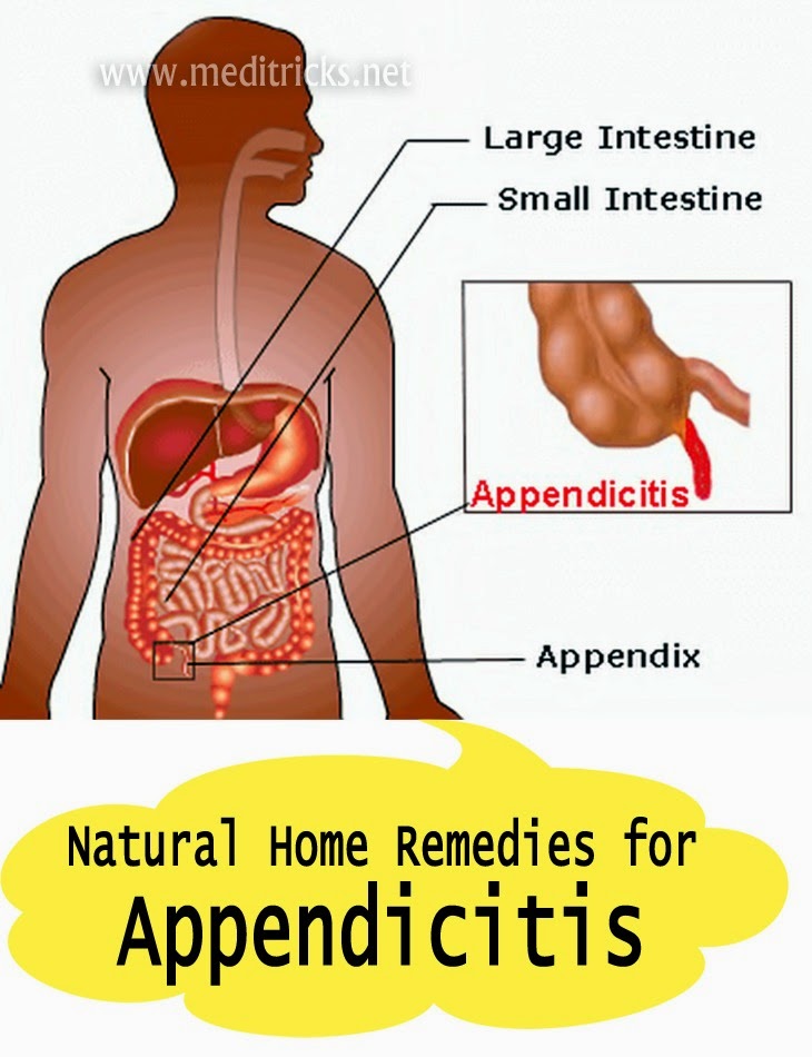 Аппендицит с какой стороны симптомы у мужчин