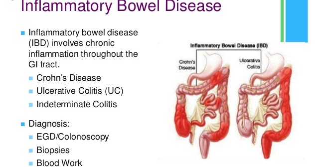 Inflammatory bowel disease in spanish
