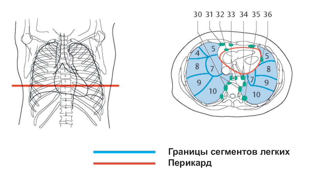 Рентген схема сегменты. Сегменты легких кт схема Radiology. Сегменты легких на кт схема корональные срезы. Сегменты лёгких на кт аксиальный срез. Сегменты легких на кт в аксиальной проекции.