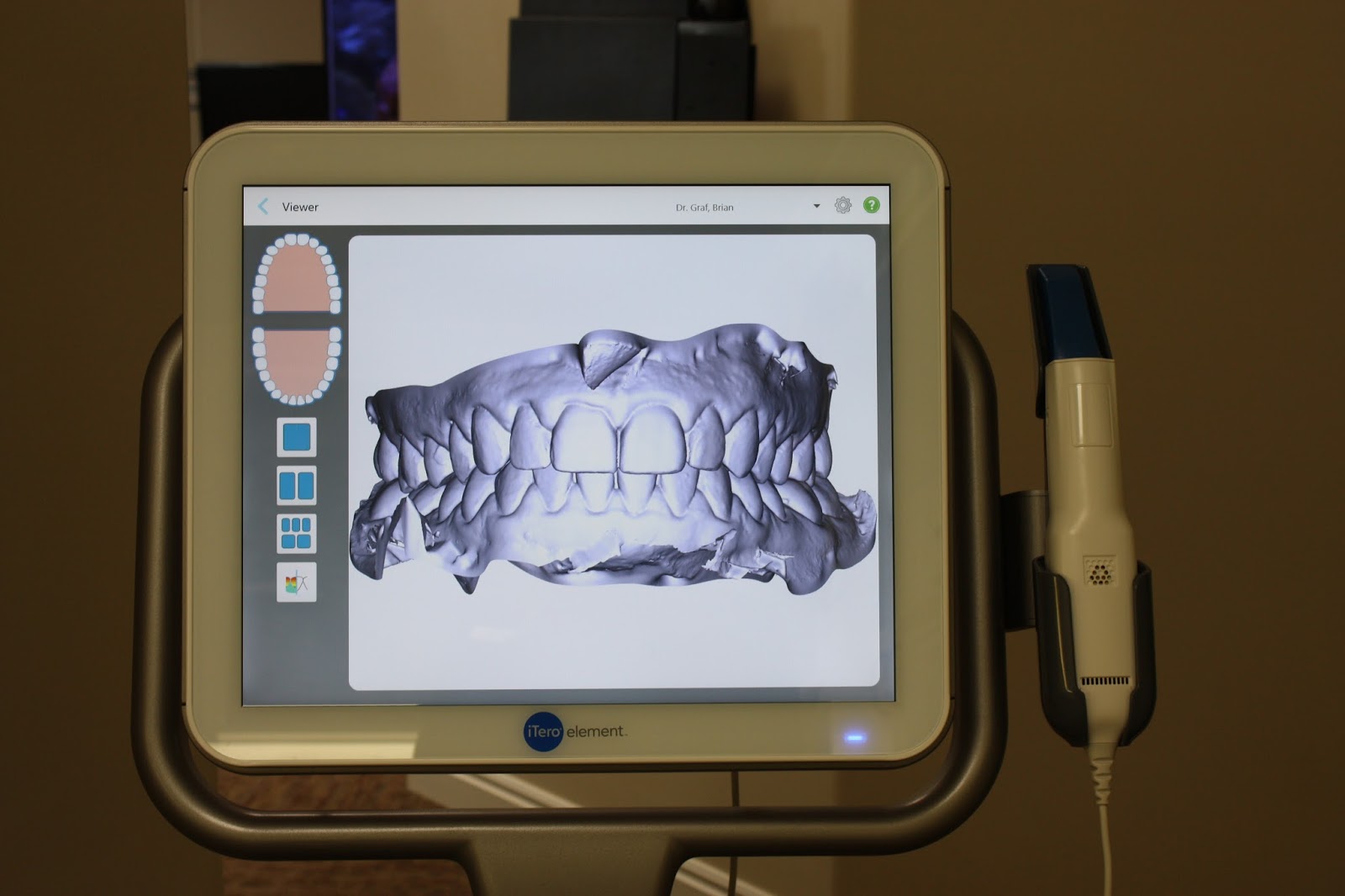 Graf Orthodontics No more gagging, messy impressions!