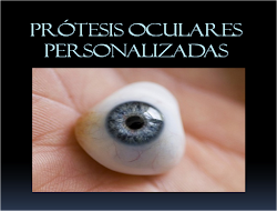 Adaptación de prótesis oculares.