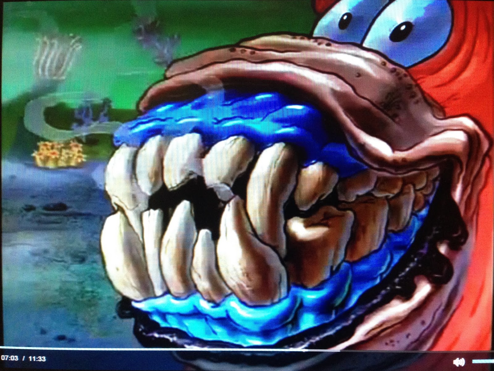 Patrick's ugly Teeth.