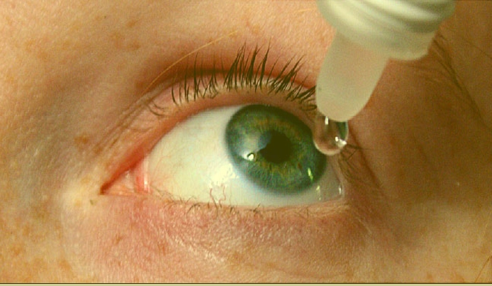 افضل قطرة لعلاج جفاف العين - طب كلينك