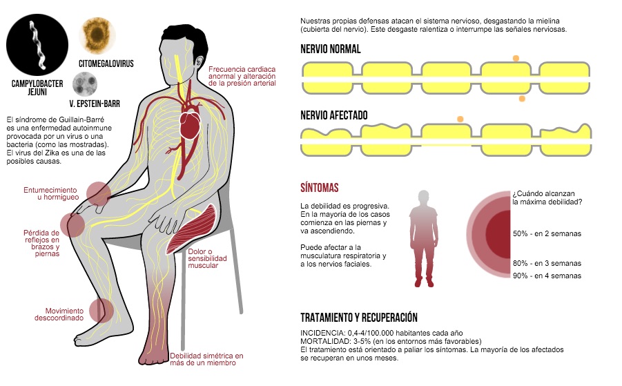 Sintomas del colitis nervioso