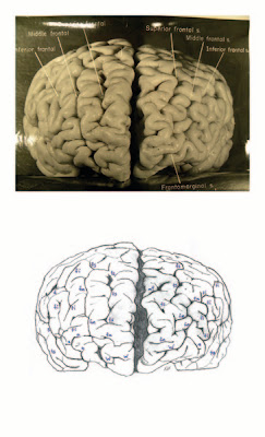 otak Albert Einstein