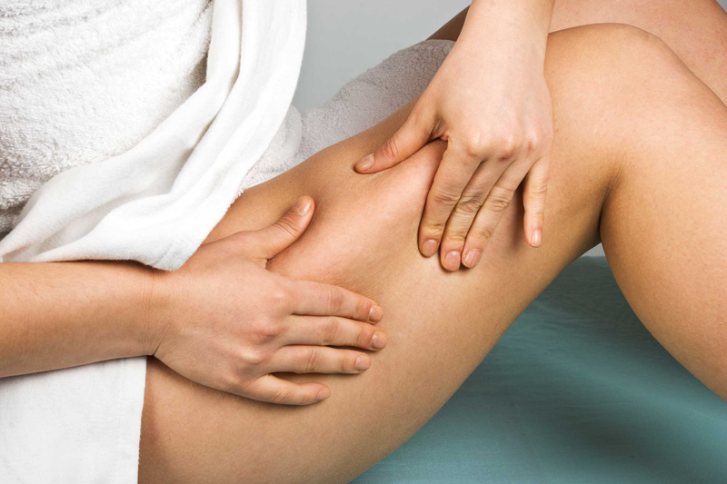 You could get stretch marks 12 Ways Smoking Cigarettes Ruins Your Looks