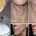 Natural Home Treatment That Can Defeat Botox for Tightening and Clears Pore Skin