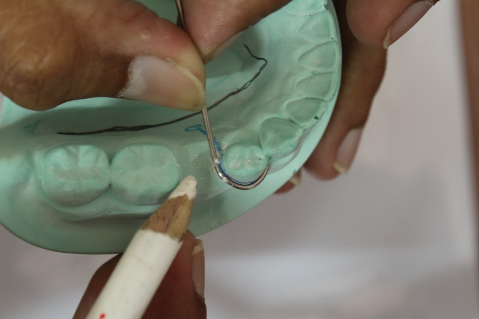 Step by step Guide for Understanding the Prosthodontics Making clasp