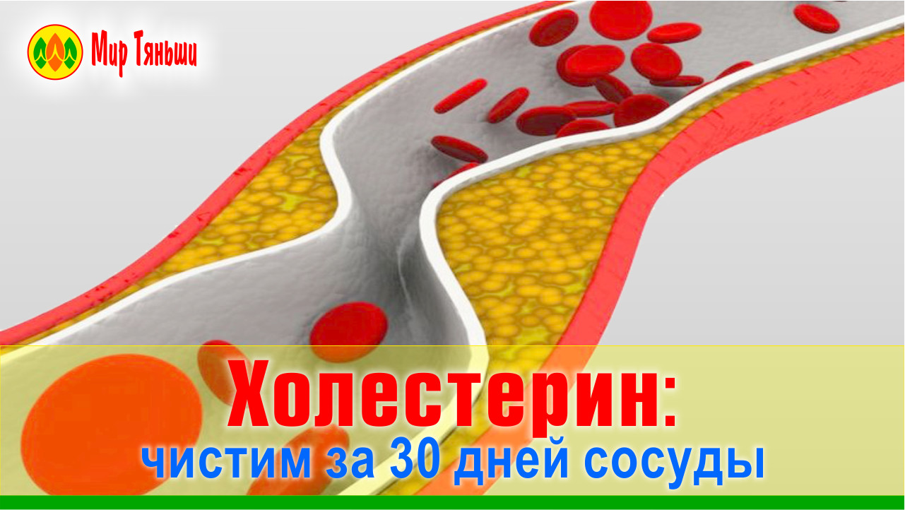 Рецепт для очистки сосудов от холестерина. Народные средства для очистки сосудов. Как почистить сосуды от холестерина. Как почистить сосуды от холестерина. Очищение сосудов от холестерина.
