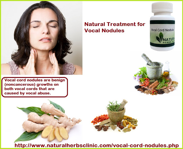 Vocal Cord Nodules Natural Treatment