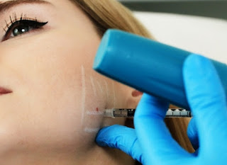 Diş Sıkma Tedavisi Botox