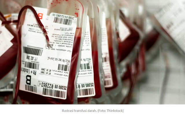Transfusi Darah dari Wanita Hamil ke Pria Tingkatkan Risiko Kematian