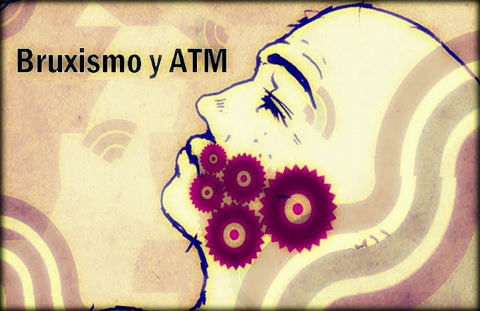 BRUXISMO: Alteraciones en el ATM - Entrevista Dr. Alberto Cuevas