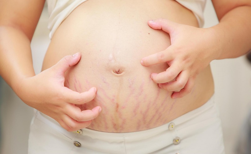 Colestase Intra-Hepática da Gravidez: Sintomas e Tratamento
