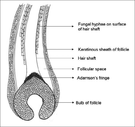 Light Green Yeast Infection Guide