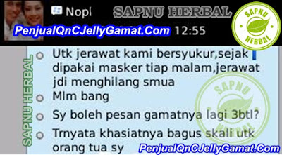 Cara Alami Menghilangkan Bopeng Bekas Jerawat Di Wajah Sampai Tuntas Cara Alami Menghilangkan Bopeng Bekas Jerawat Di Wajah Sampai Tuntas