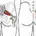 TAKE THIS AND YOU WILL NEVER HAVE TO SUFFER FROM SCIATICA OR BACK PAIN AGAIN!