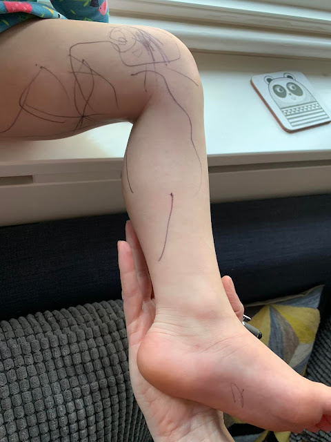a toddler leg covered in biro drawing