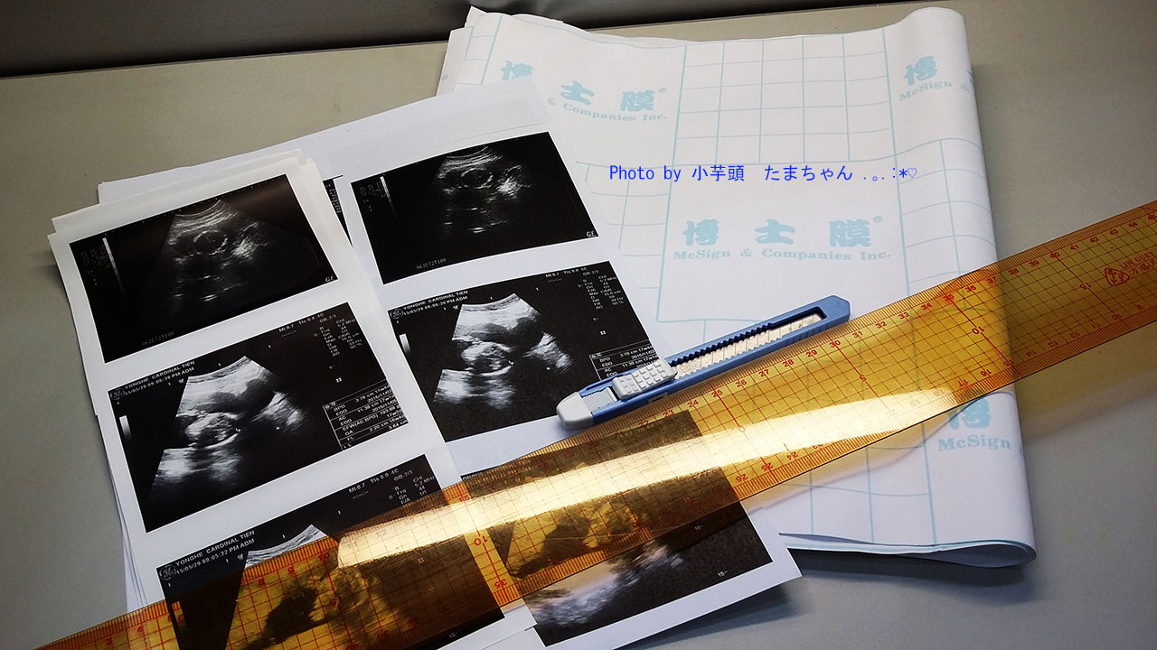 小芋頭的幸褔二加一進行式 孕事 如何保存珍貴的胎寶寶超音波照片 不建議用這個方法 會淡化