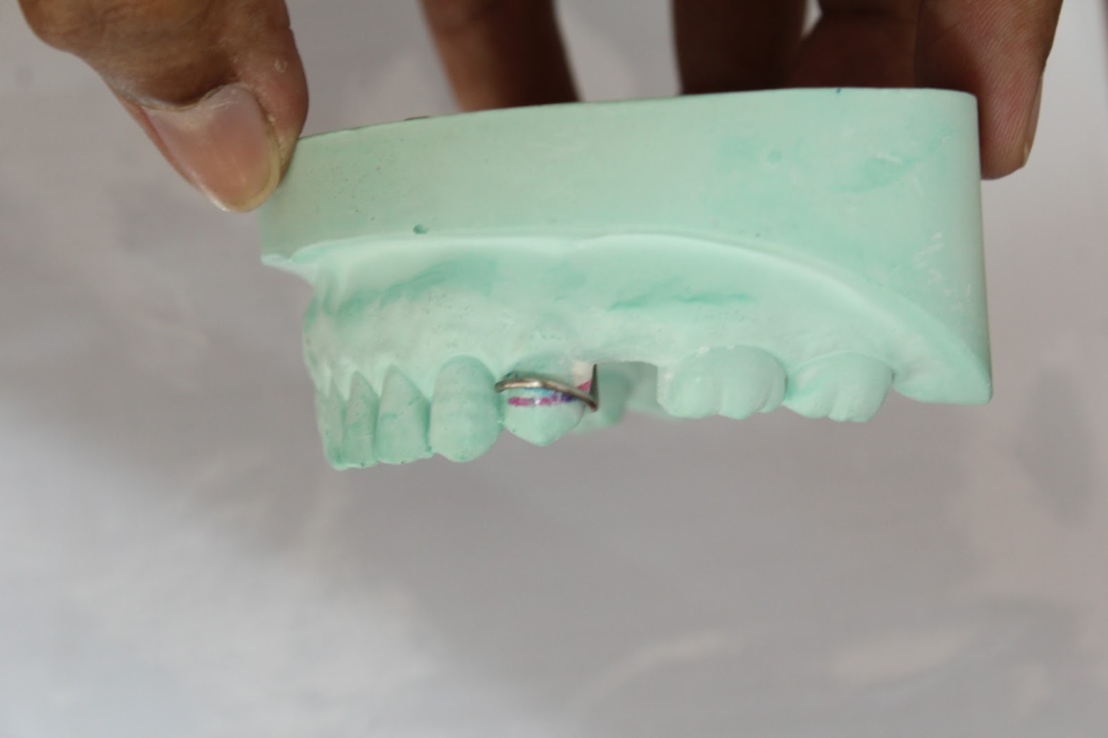 Step by step Guide for Understanding the Prosthodontics Making clasp