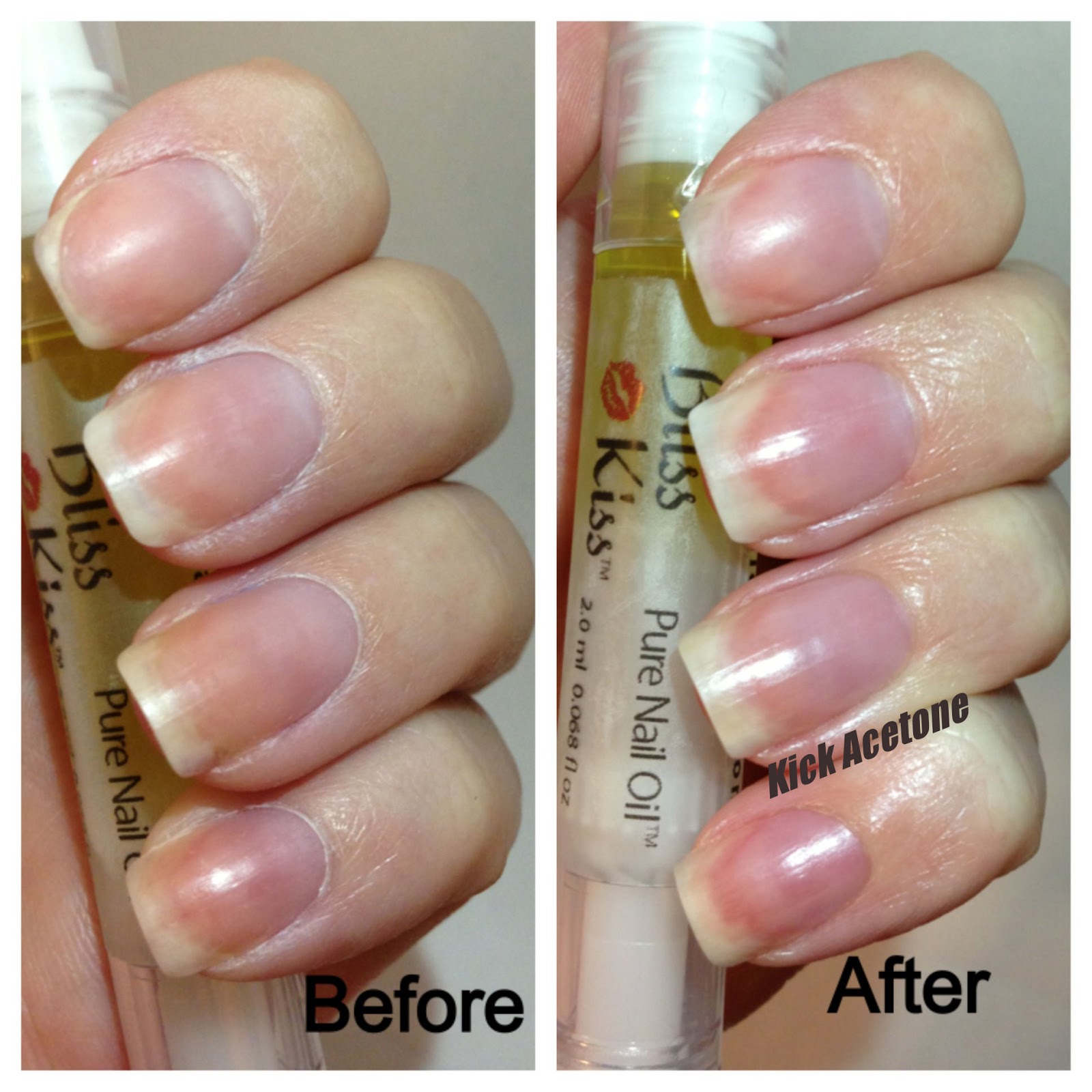 Kick Acetone Bliss Kiss Pure Nail Oil™