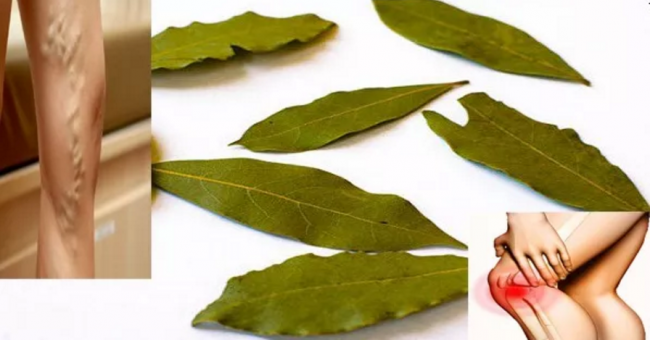 No More Varicose Veins, Joint Pains, Memory Problems Or Headaches Thanks To This Miraculous Leaf!