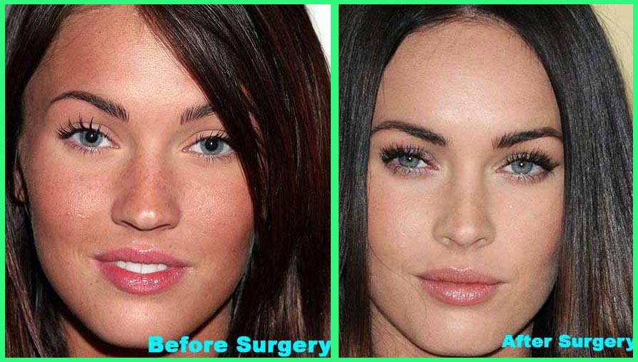 Plastic Surgery Before And After Megan Fox Before And After