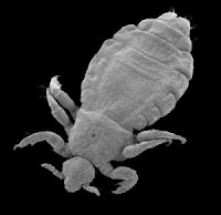 human head louse under microscope