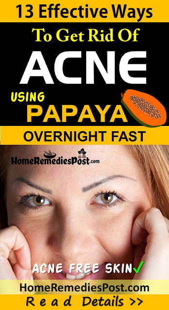 Papaya For Acne, Is Papaya Good For Acne, Papaya Acne, Papaya For Pimples, Papaya And Acne, How To Get Rid Of Acne, How To Get Rid Of Acne Fast, Home Remedies For Acne, Acne Treatment, How To Cure Acne