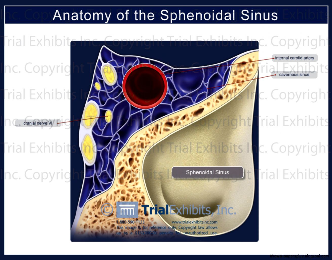 Sinus Anatomy Hd Wallpapers Plus | Images and Photos finder